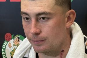 颈部有明显血痕！普理查德：训练营里的对抗像打仗一样